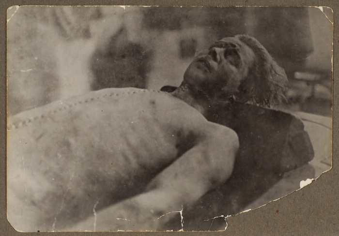 Две фотографии Сергея Есенина после смерти. 1925.